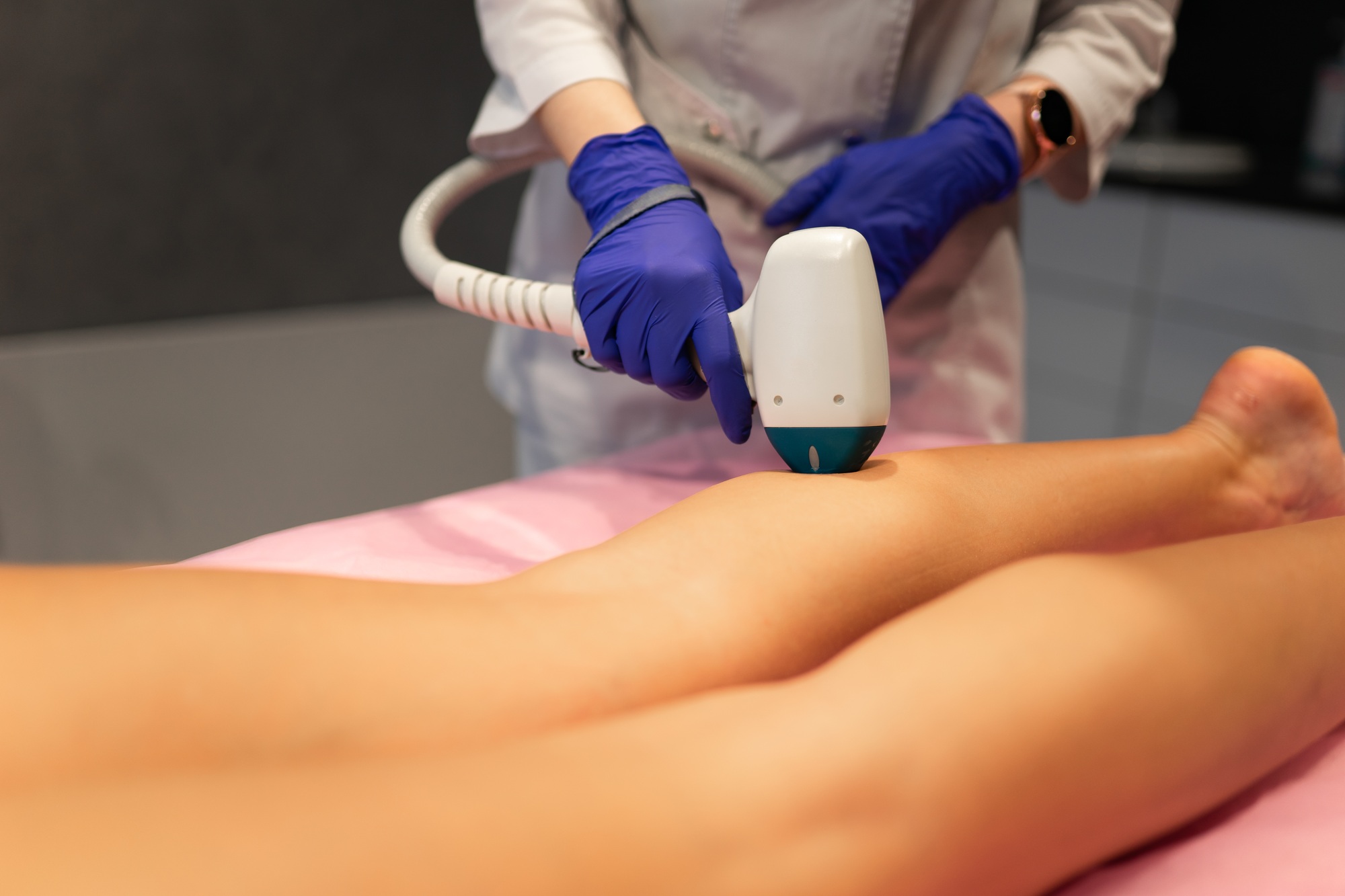 Laser depilation leg hair removal therapy